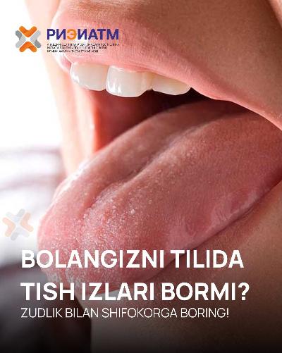 Farzandingizning tilida tish izlari bormi?